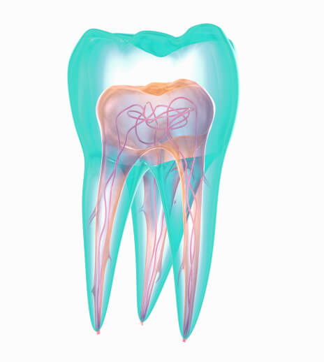 Wurzelbehandlung Zahnarzt